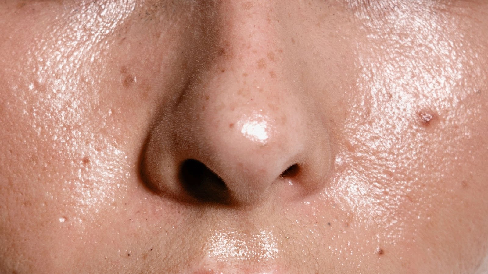 6 Tips for Keeping Oily Skin at Bay - Koope